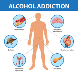 Alcohol addiction or alcoholism information infographic