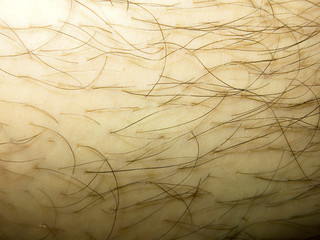 human leg skin with frequent black hair
