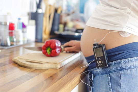 Pregnant woman with insuline pump on her pants and drainage mounted on her belly in kitchen preparing healthy food. Modern diabetes treatment.