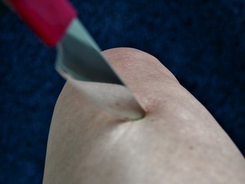 Messer sticht in Bein