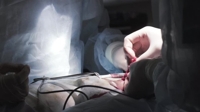 Close up detail of a surgery on male urogenital system. Action. Surgeons hands cutting out testicle malignant tumor with professional tools, concept of cancer disease and medicine.