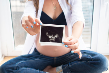 A pregnant woman holds an ultrasound image of her child: the concept of women's health