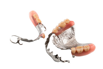 Set of partial metal upper and lower removable dentures on white background.