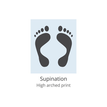 Supination - high arched print of human foot with medical deformity and leg anatomy problem