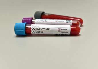 Coronavirus Covid 19 infected positive result blood test sample in research tube in laboratory where vaccine research is tested on Covid-19 