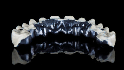 titanium bar of the upper jaw, view from the inside on a black background © Dental Pro Content