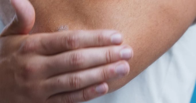 Man applying ointment on his elbow to treat dry skin, close up