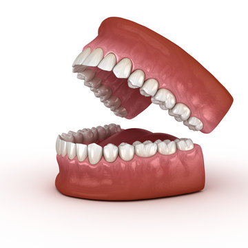 Dental anatomy - Opened Dentures. Medically accurate dental 3D illustration
