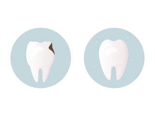 Dentistry set. Healthy white tooth without damage and tooth damaged by caries. Protection of teeth and enamel. oral hygiene. urgent medical dental care in the restoration and treatment of the tooth