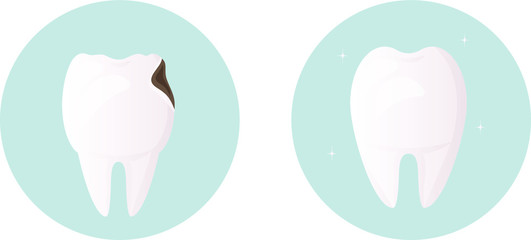 Dentistry set. Healthy white tooth without damage and tooth damaged by caries. Protection of teeth and enamel. oral hygiene. urgent medical dental care in the restoration and treatment of the tooth