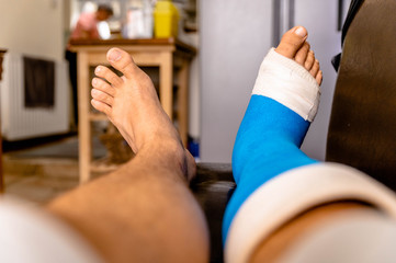 Male resting cast on chair elevated from foot surgery