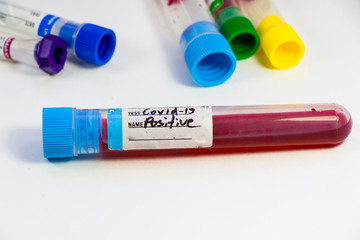 Covid - 19 and corona virus blood test sample, negative and positive