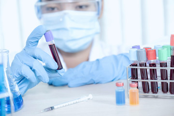 doctor's hand holding a sample blood tube for analysis and test virus disease in the laboratory,...