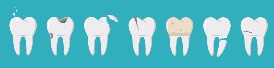 A set of human teeth with different injuries. Healthy and diseased tooth, caries, broken root, plaque, spots, crack. Banner, poster for printing. Infographics in dentistry. Vector. Flat style.