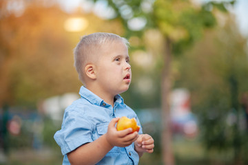 The daily life of a child with disabilities. A boy with Down syndrome eats a peach. Chromosomal and...