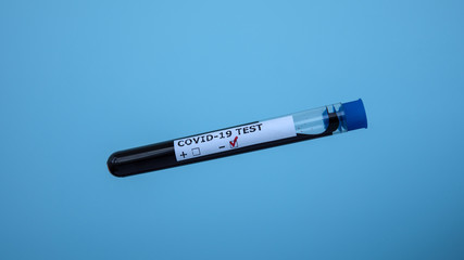 Obraz premium Test tube with blood sample for COVID-19, isolated on blue background. Negative test result from Coronavirus Covid-19. Medical concept. A blood test for the virus presence.