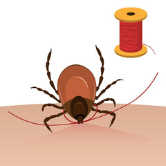 A tick is taken out of the skin with a thread. Tick bite. Vector illustration