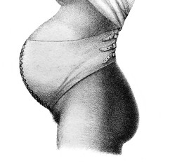 Belly of a pregnant woman in a bandage in the old book Atlas Abildungen by D. W. Busch, Berlin, 1841