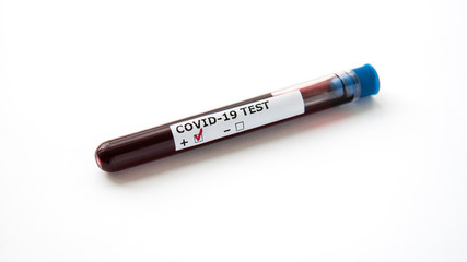 Close-up photo of test tube with blood sample for Coronavirus, isolated on white background. Covid-19 testing. Positive test result from Coronavirus Covid-19. Medical concept. 