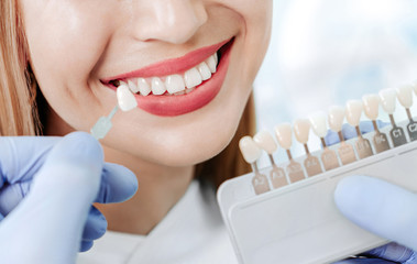Smiling female mouth with natural white teeth in light blue background in dental clinic. Hands doctor dentist with teeth color palette next by face. Smile healthy teeth concept