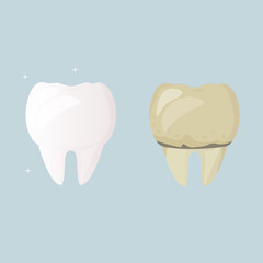 Whitening and teeth cleaning. Tooth before treatment and brushing yellow and sick, after white and healthy. Daily Oral Hygiene. Dental Design Poster