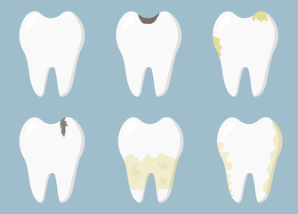 Dental diseases. Tooth decay, inflammation, dental plaque, periodontal disease. Concept of dentistry and medicine.