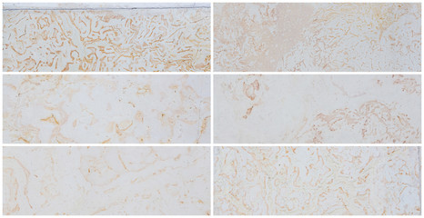 Dolomite texture set. Collection of panoramic stone backgrounds. Natural rock with beautiful light beige patterns on the surface. Wide panoramas with polished flat stones. Decoration building material