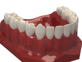 Removable orthodontic appliance is used after orthodontic treatment for retention. 3d render