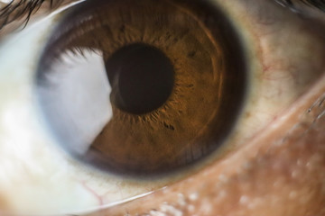 pretty eye corneas with brown color