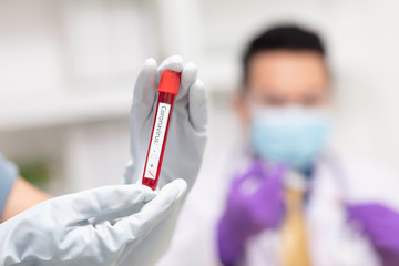 Close up science hand hold bood positive result from Coronavirus (COVID-19) Testing
