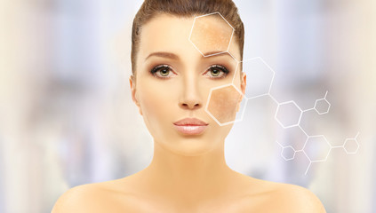 Dark spots, freckles,hyperpigmentation(melasma or chloasma),concept- skin lightening, skin...