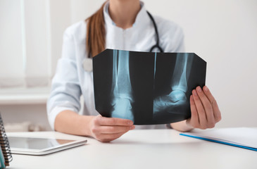 Orthopedist examining X-ray picture at desk in office, closeup
