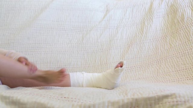 broken leg. Close-up of the cast on the feet. exercises to repair and strengthen muscles. damage to the bones. medical care of a surgeon in the emergency room