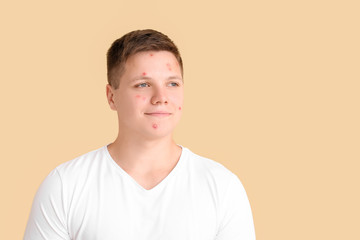 Fototapeta premium Teenage boy with acne on color background
