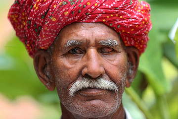 Old Indian man in long white mustache and wearing red turban suffering from eye problem. Cataract...