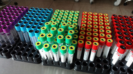 Tampone faringeo ft0208_1246 Cultivo nasofar&iacute;ngeo  Nasopharyngeal swab Zaragota nasofar&iacute;ngea