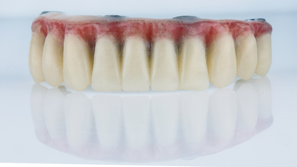 inverted dental prosthesis of the lower jaw with artificial gum on a white background