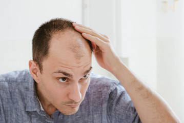 Young man looking at mirror worry about balding.