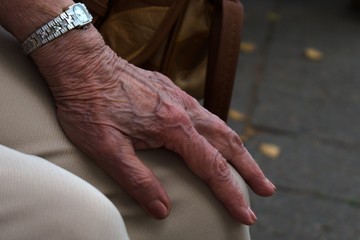 elderly woman hand with a watch on her knee