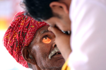 Old Indian man in Yellow turban from Rajasthan getting eyes tested. Eye camp. Eye patient. Weak eyesight. Eye Health. Eye examination by doctor. Healthcare to elderly. 