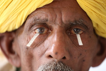 Old Indian man in turban from Rajasthan getting his eyes tested. Schirmer's test. Dry eye test.Testing level of tears in eyes.Eye testing strip. Eye camp.   