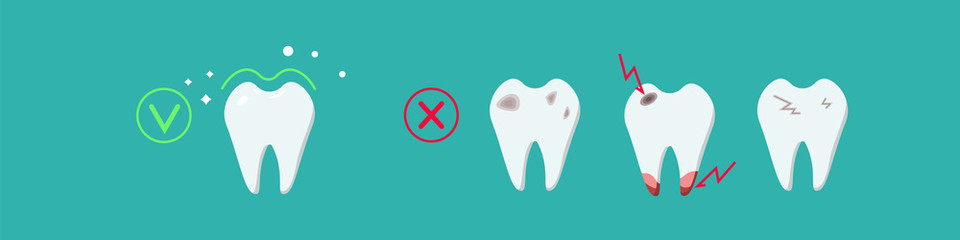 Sick, destroyed teeth: dental plaque, caries, chips, and cracks and healthy clean teeth. Dental care for teeth. Vector illustration in a flat style isolated on a blue background