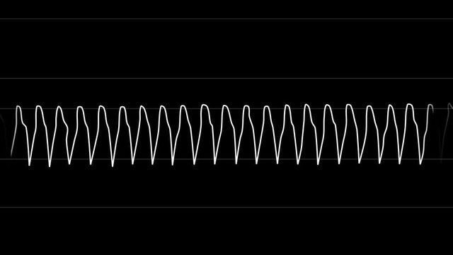 PNG Alpha.ECG looping.Vtach.Heart rate Ventricular tachycardia. Heart beat line template.Cardiogram monitor.Technological HUD for medicine and science,Medical Institute students.Type 5