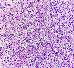 Normal parathyroid tissue, photo under microscope