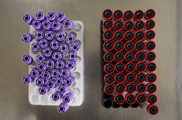 High angle view of test tubes with blood samples on the table at hospital