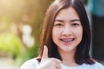 Portrait of Asian teen beautiful young woman smile have dental braces on teeth laughing outdoor,...
