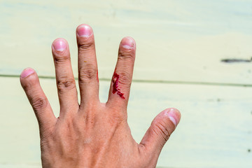 Real blood  on finger after knife accident