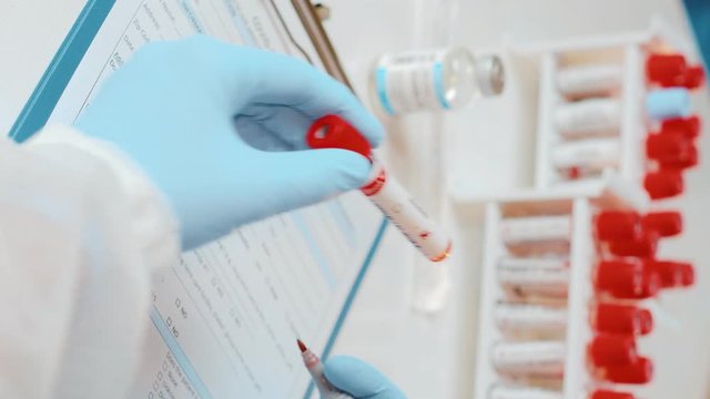 Vertical footage laboratory technician holds in one hand laboratory positive blood sample for alcohol test, other handwriting down results to patients medical records. Laboratory medical diagnostics