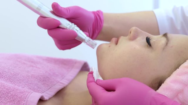 The cosmetologist makes the procedure Microdermabrasion of the facial skin of a beautiful, young woman in a beauty salon.Cosmetology and professional skin care.