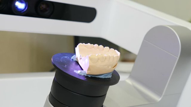 3d jaw scanning in modern dentistry. Dental prosthetic restoration. Dentist making 3D model for sculpted plastic denture with high tech digital scanning equipment. 4 k video